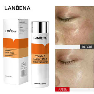 LANBENA Vitamin C Facial Toner Brightening Skin 100ML